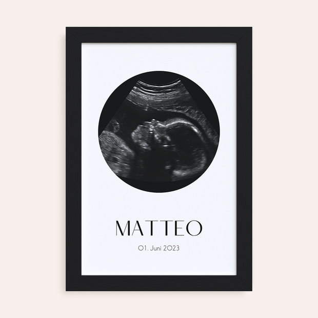 Geschenke für werdende Mütter - Ultraschallbild-Poster 